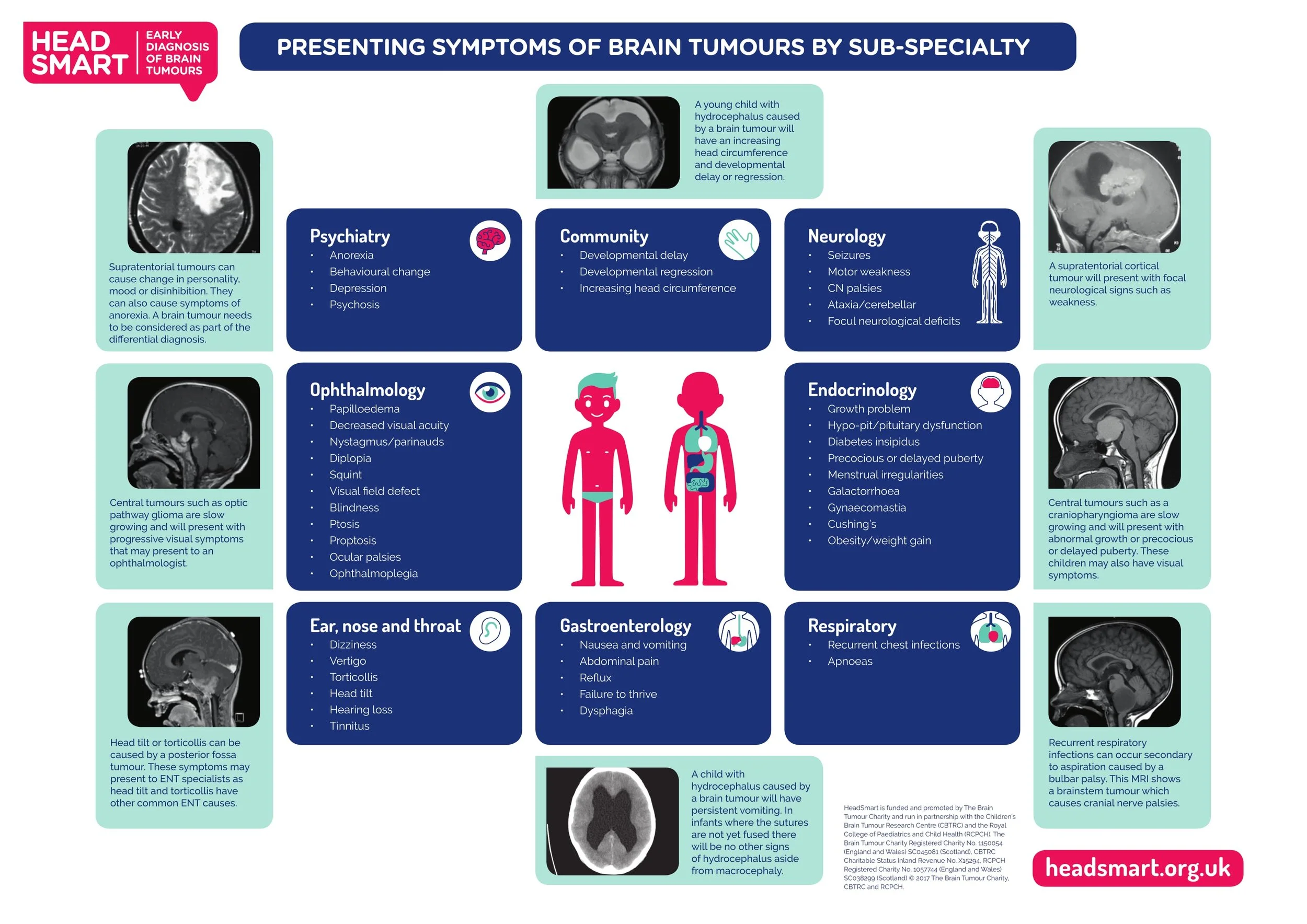 Head Smart Sub-Speciality Summary Poster