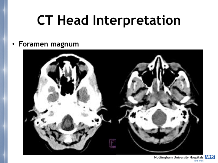 Neurosurgery in the emergency department.005.jpeg