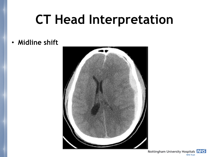 Neurosurgery in the emergency department.008.jpeg