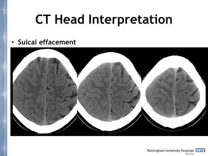 Neurosurgery in the emergency department.009.jpeg