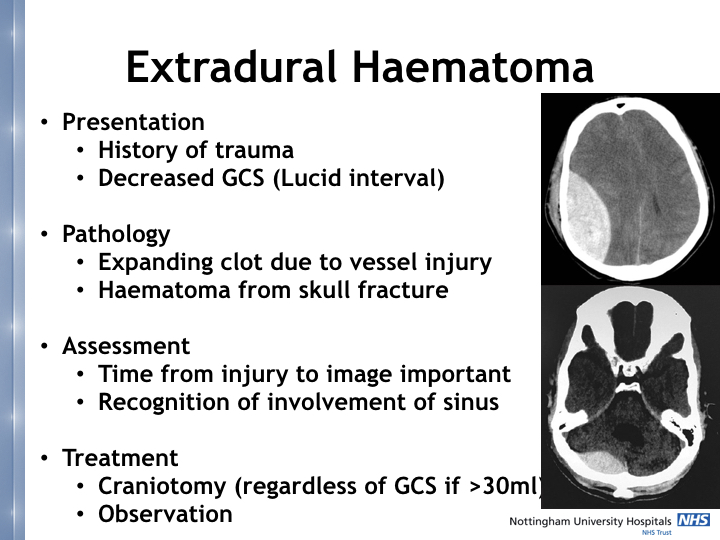 Neurosurgery in the emergency department.013.jpeg