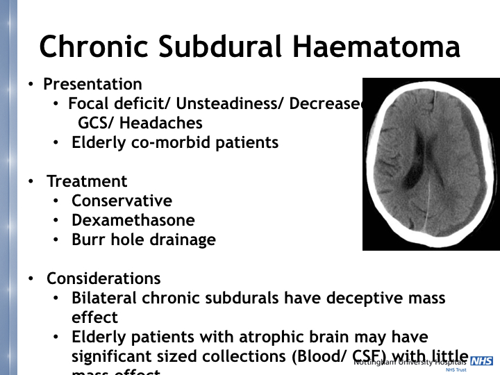 Neurosurgery in the emergency department.016.jpeg