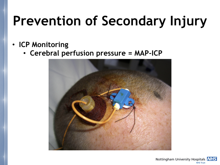 Neurosurgery in the emergency department.020.jpeg