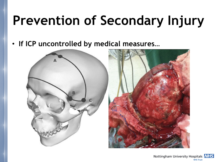 Neurosurgery in the emergency department.021.jpeg