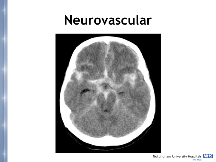 Neurosurgery in the emergency department.023.jpeg