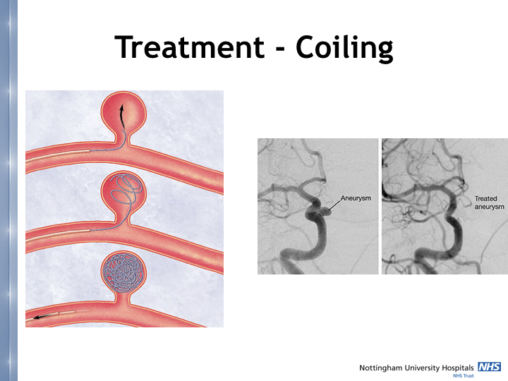 Neurosurgery in the emergency department.029.jpeg
