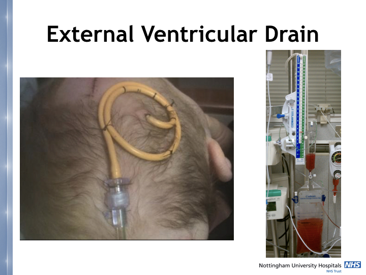 Neurosurgery in the emergency department.039.jpeg