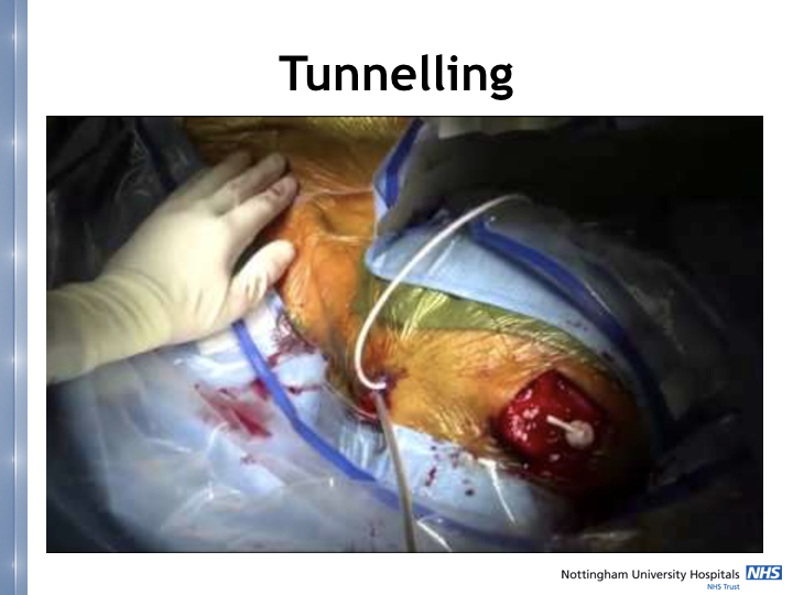 Neurosurgery in the emergency department.043.jpeg