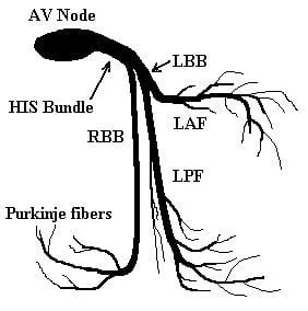 avhisbb.jpg