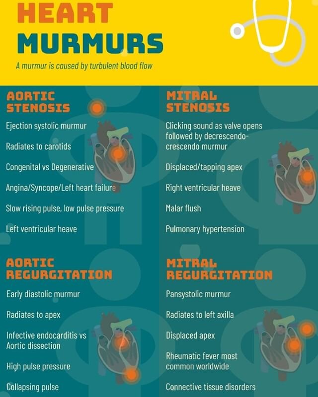 Here is our #TakeVisually #infographic on Heart Murmurs from the podcast https://www.takeaurally.com/adult-emergency-medicine/2020/5/29/heart-murmurs available on Apple Podcasts, SoundCloud and Spotify #foamed #medicine #medicaleducation #cardiology 