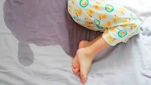 Talking about wees, a physiotherapists approach to bedwetting