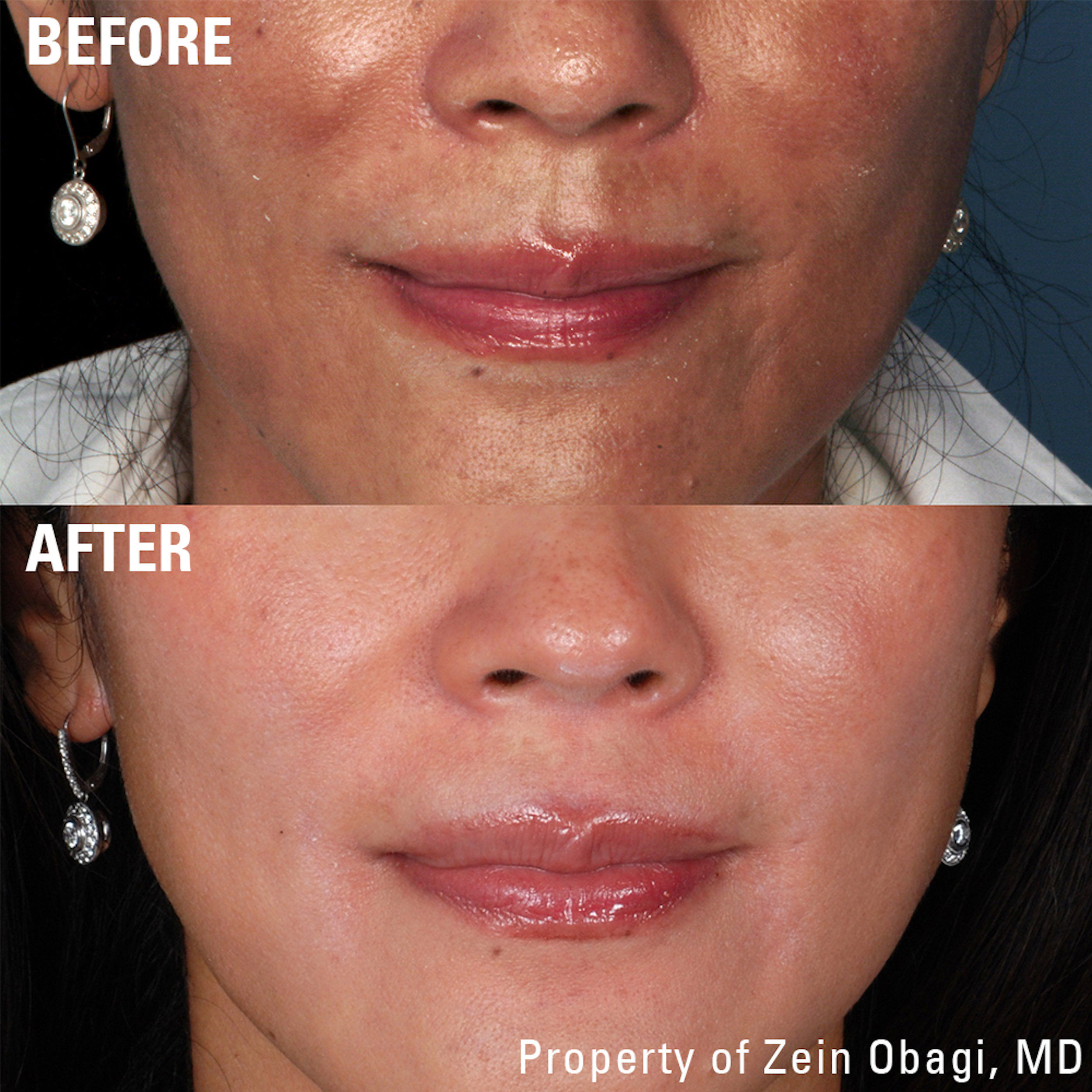 ZO Non-Hydroquinone Hyperpigmentation System.jpg