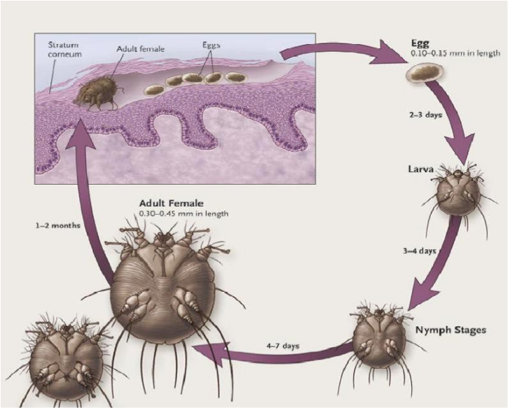 Life cycle of Sarcoptes scabiei - showcasing the burrows created by females where eggs are deposited. (Photo | Arlian, 1989 )