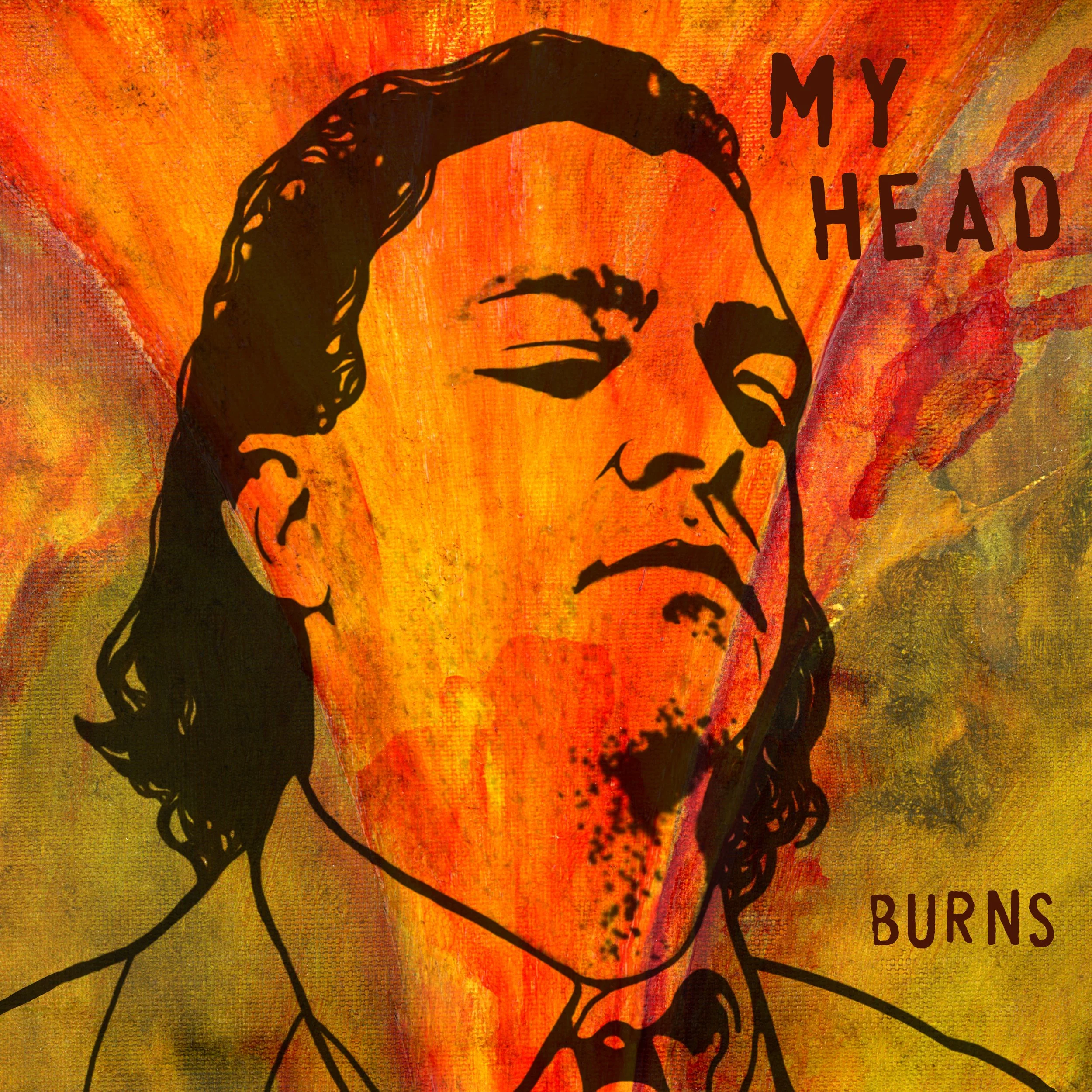 myhead burns.jpg