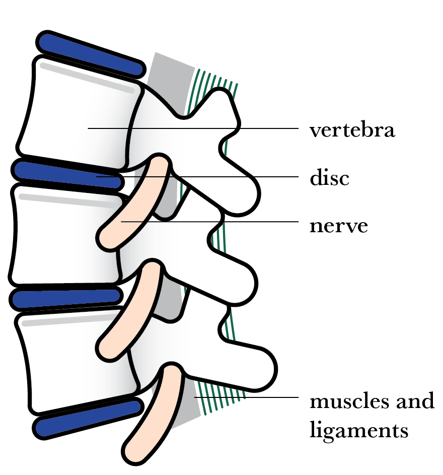 Pinched Nerve and Chiropractic Adjustments