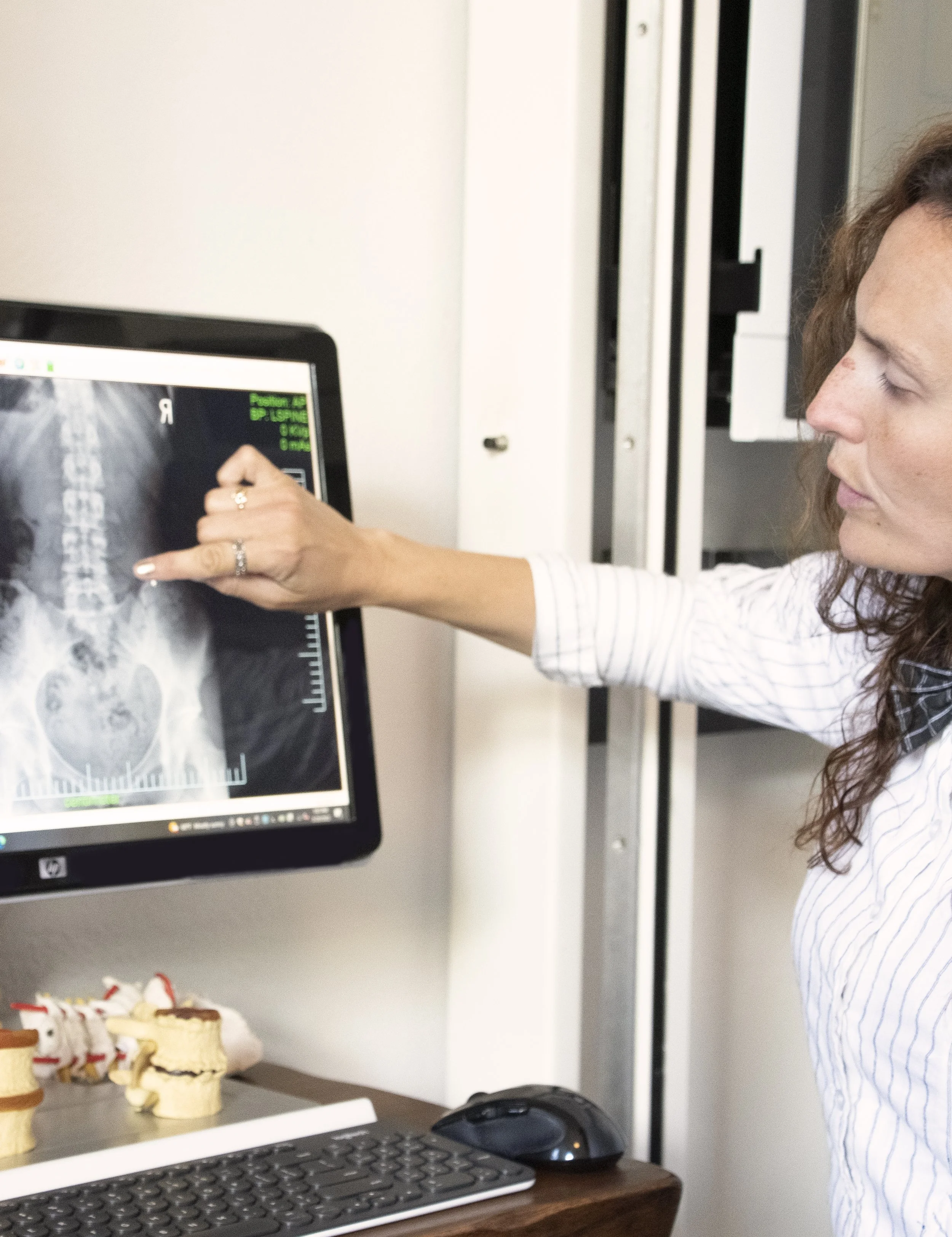X-ray, Chiropractic, Pinched Nerve, Posture