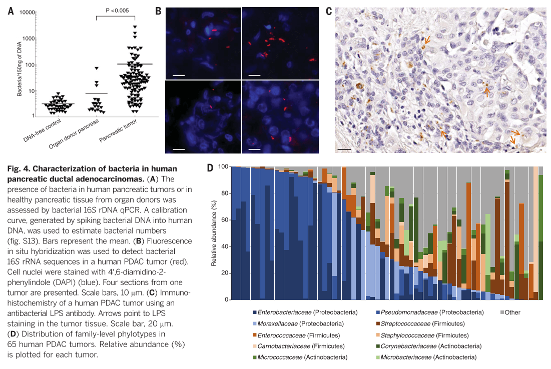 Fig. 4. Characterization of bacteria in human pancreatic ductal adenocarcinomas.