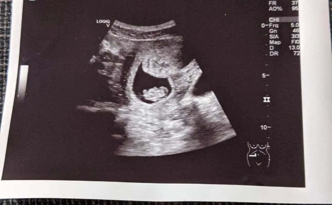 WE'RE EXPECTING! Annual update - and pricing update