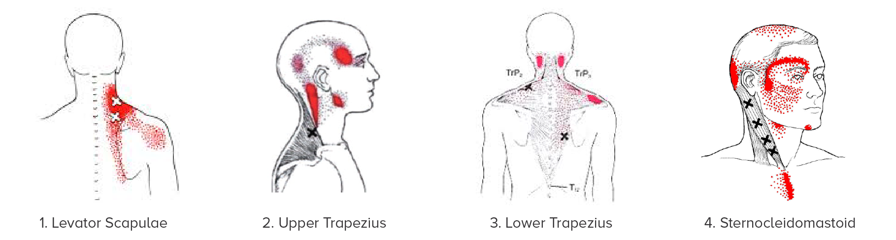 What could possibly be going on with your neck? Three main reasons for neck  tension - Sequence Wiz