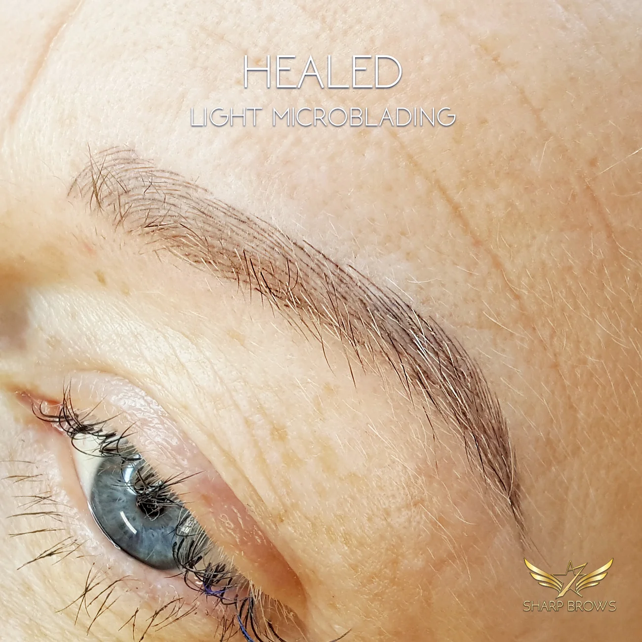 Healed result. Close-up from a perfectly healed result before the retouch. All lines can be seen and are sharp.