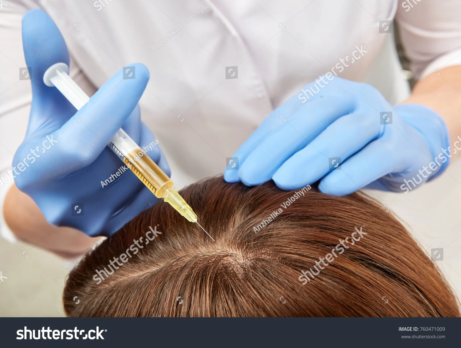 Hair PRP.jpg