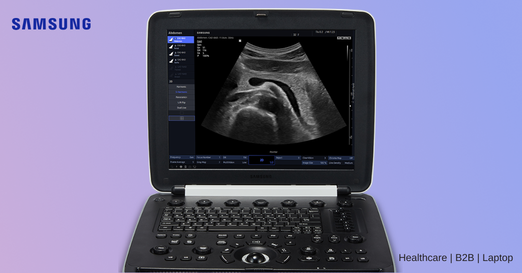 Samsung HM70 EVO Ultrasound Machine.png