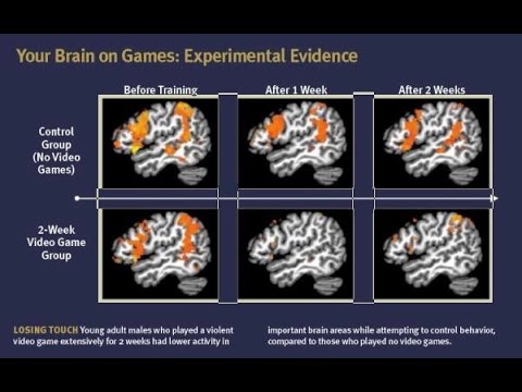 Video Games Are Literally Changing Your Brain — Beyond Science