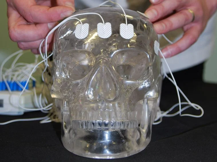 42279_crystal-skull-attached-to-eeg-machine_jfxeaqbh63vorhnrwcs4oomcjs2ptt7hevj74cagwi5qbj2htjuq_757x567.jpg