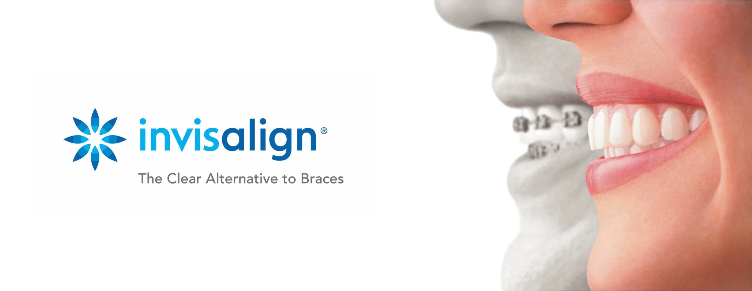 Invisalign-1-page-001.jpg