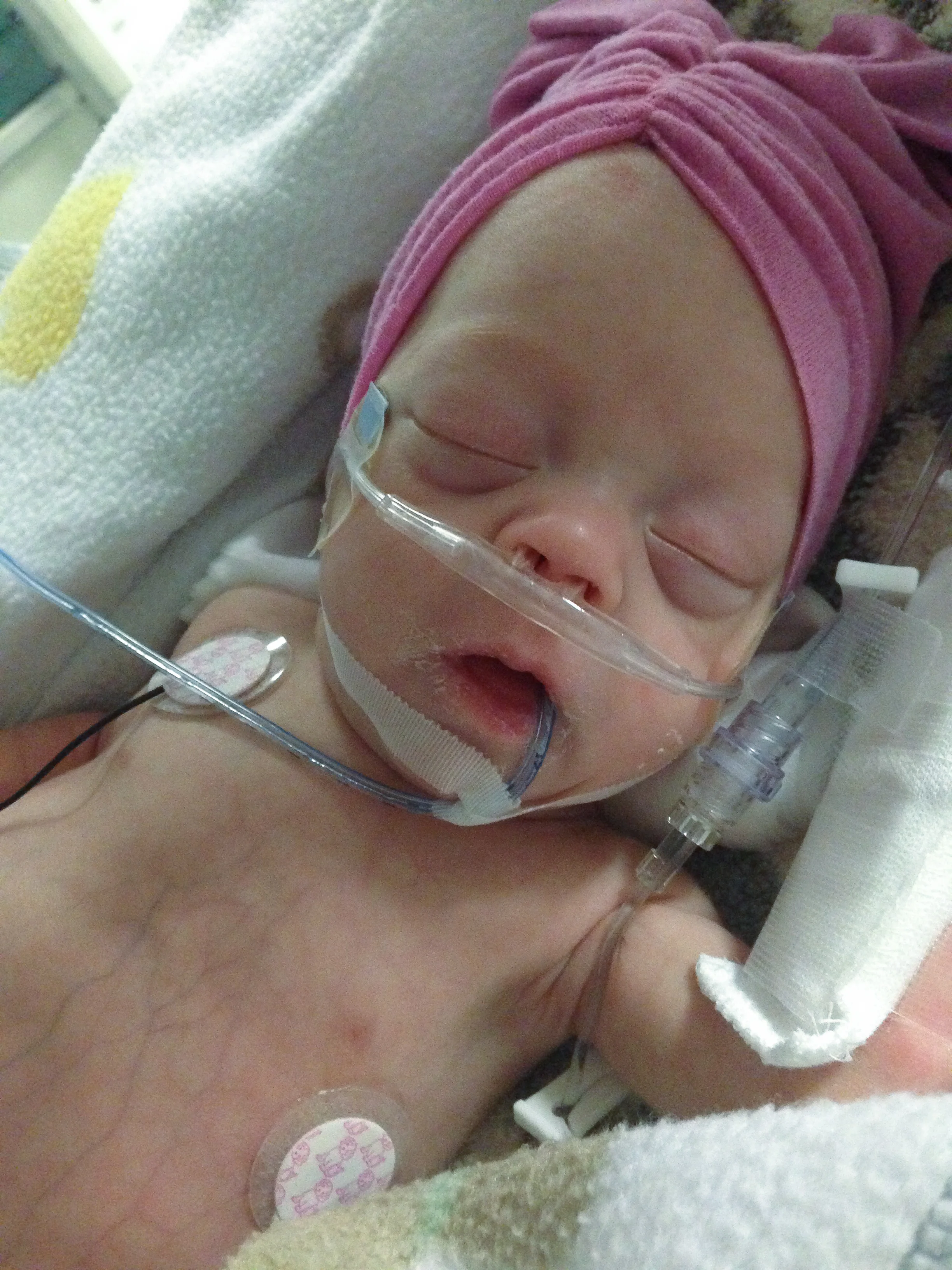 addie belle - diary of a NICU dad - day 79 - shegotguts.com-1-19.jpg