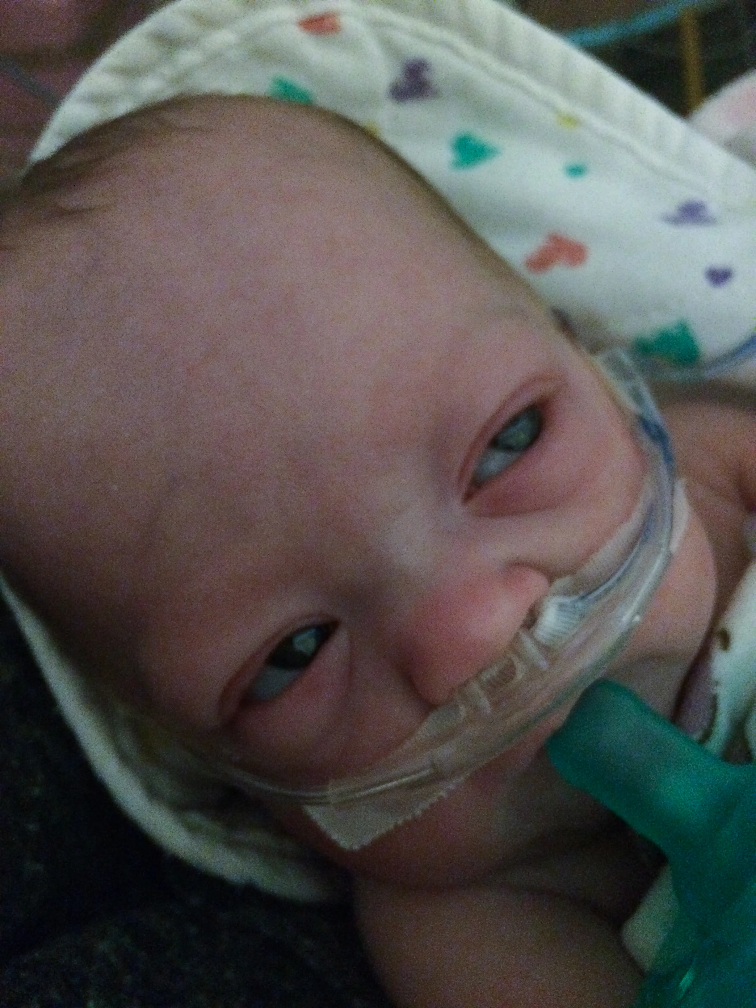addie belle - diary of a NICU dad - day 79 - shegotguts.com-1-12.jpg