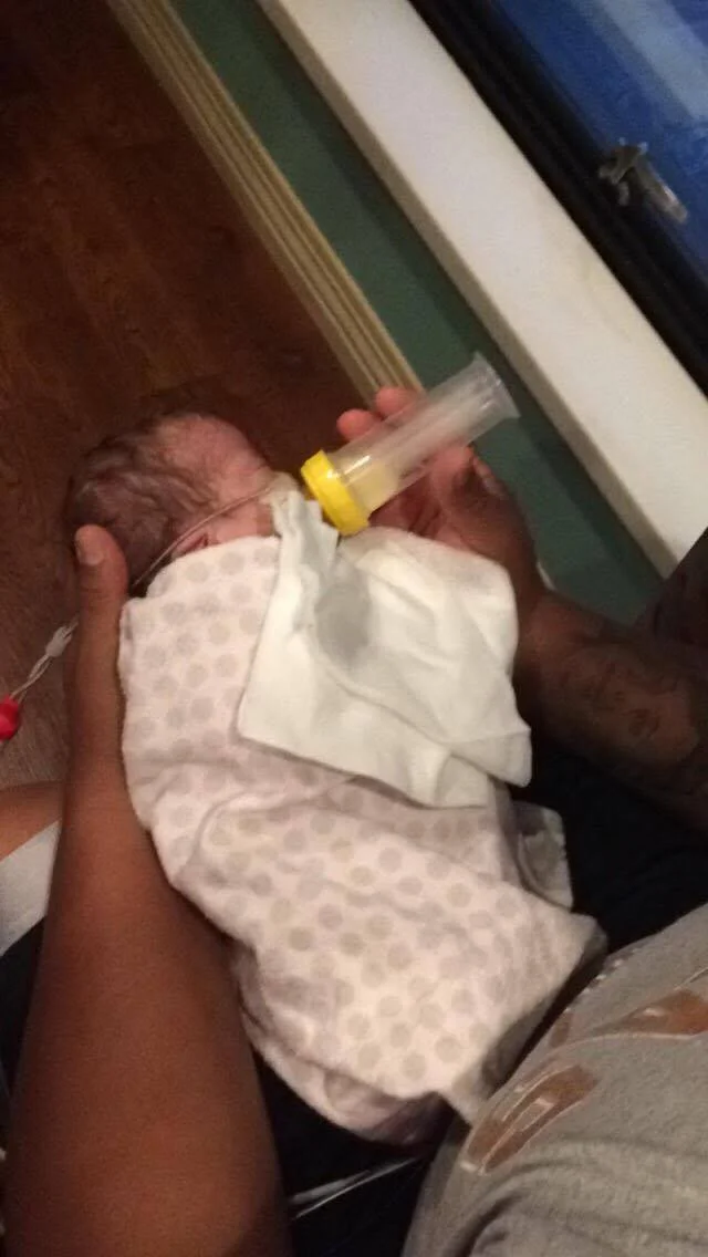 Feeding from NICU to Home A Preemie’s Journey — She Got Guts