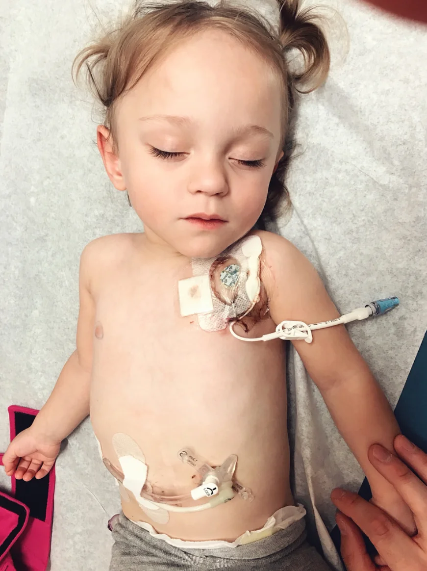 Frequently Asked Questions Feeding Tube Edition She Got Guts