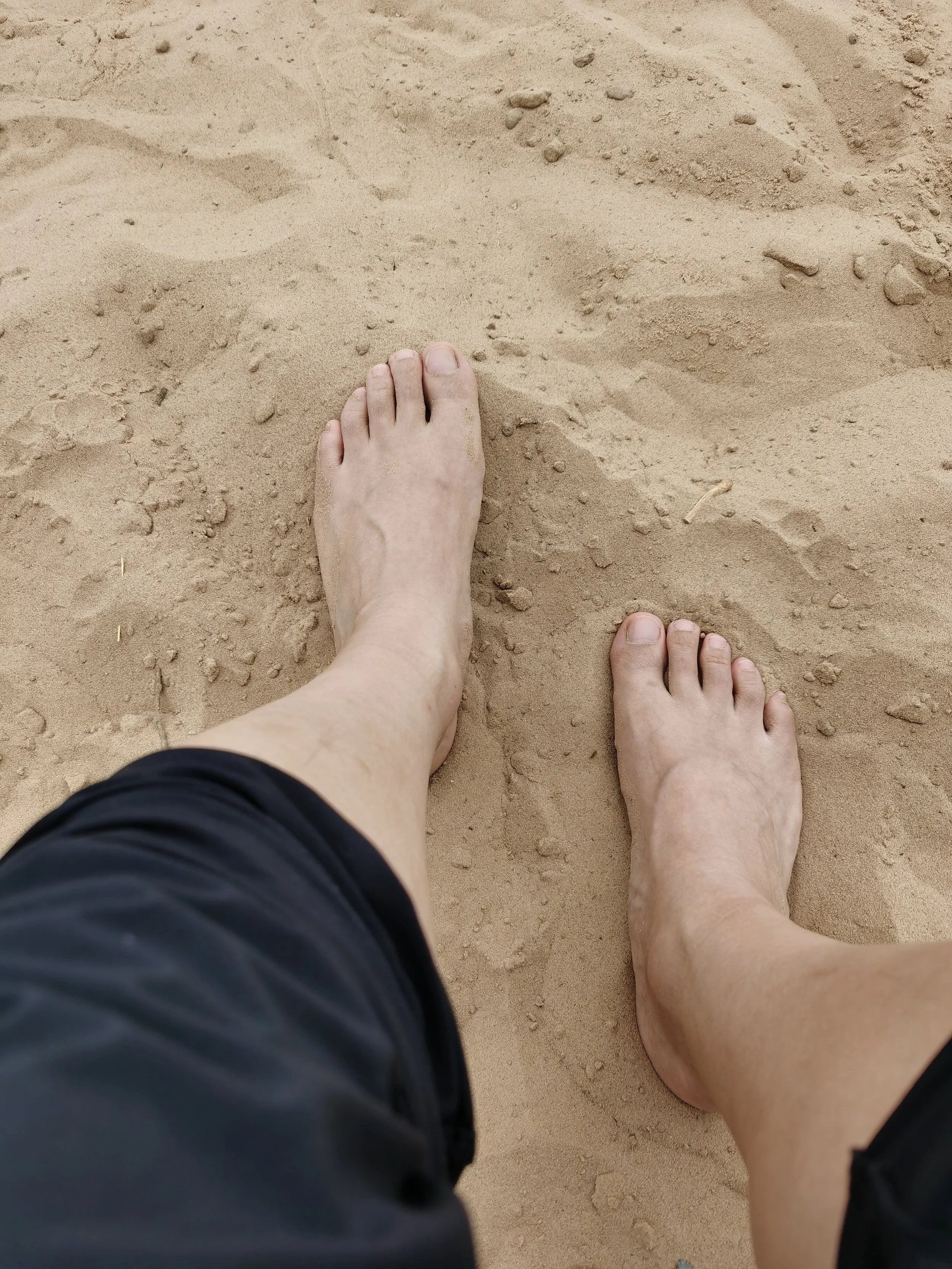 Treating Foot Drop with Acupuncture