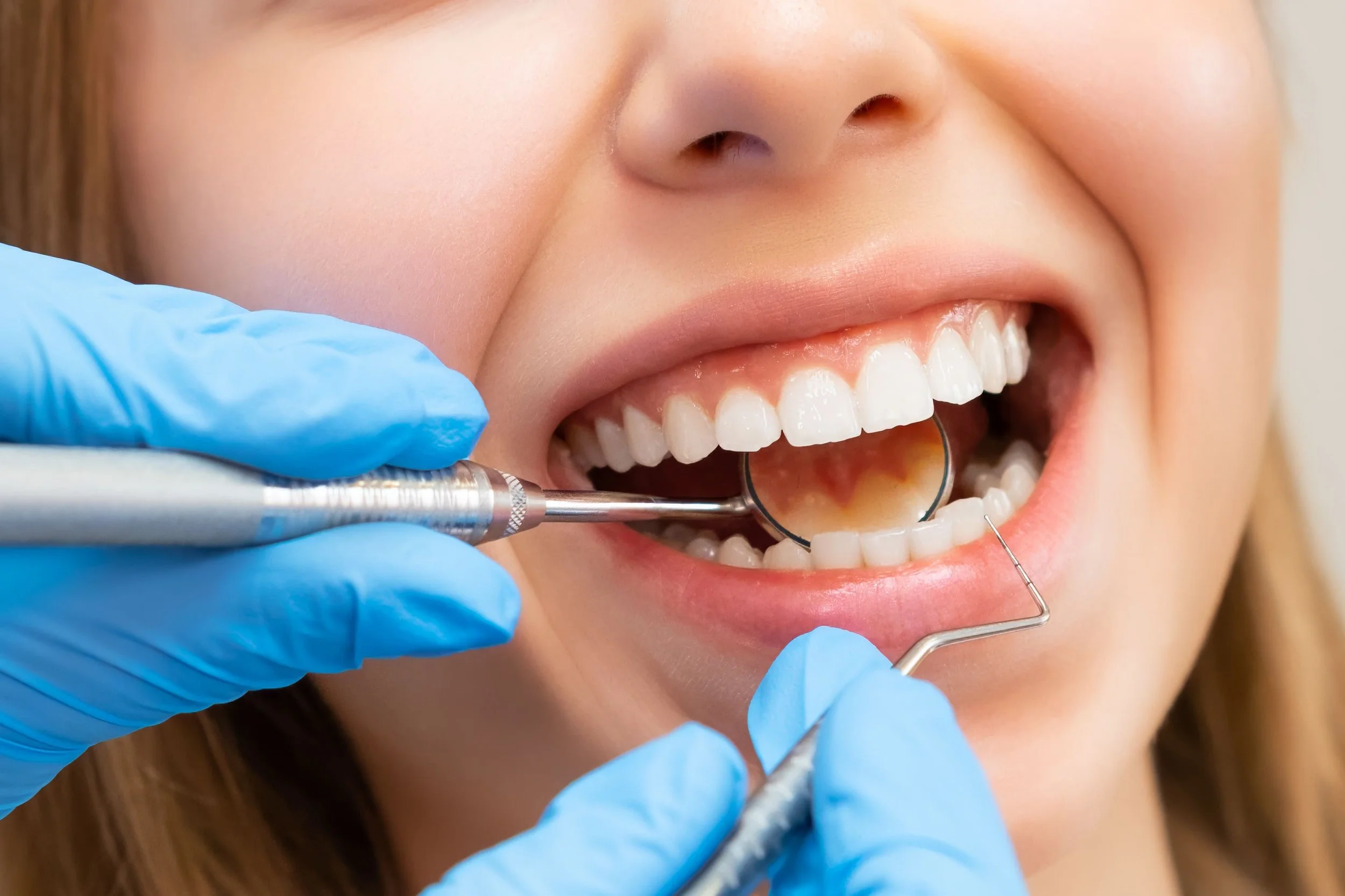 Dentista realizando un tratamiento de la encía en paciente con instrumentos odontologicos