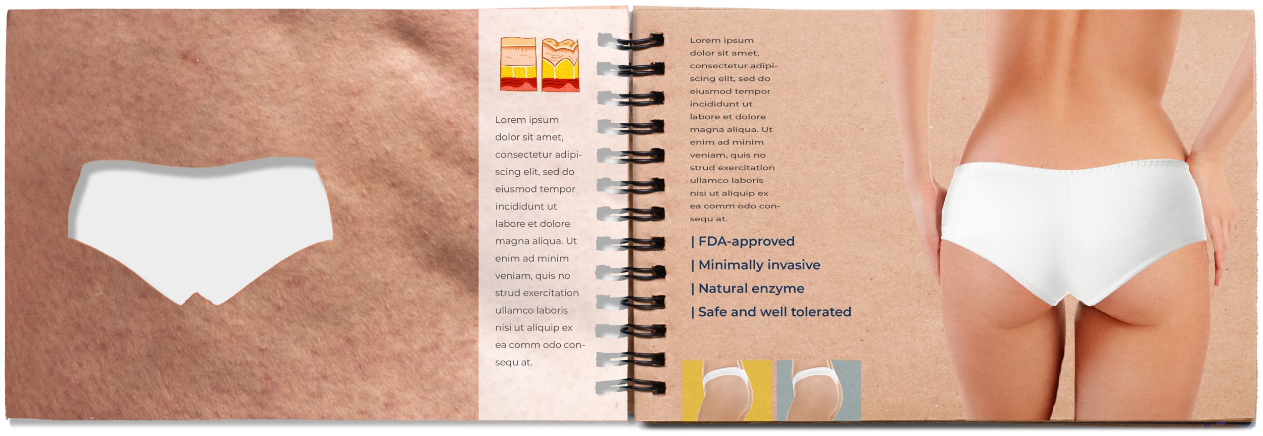 Cellulite_Direct_Mail_4.jpg
