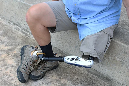 Amputee with legs crossed