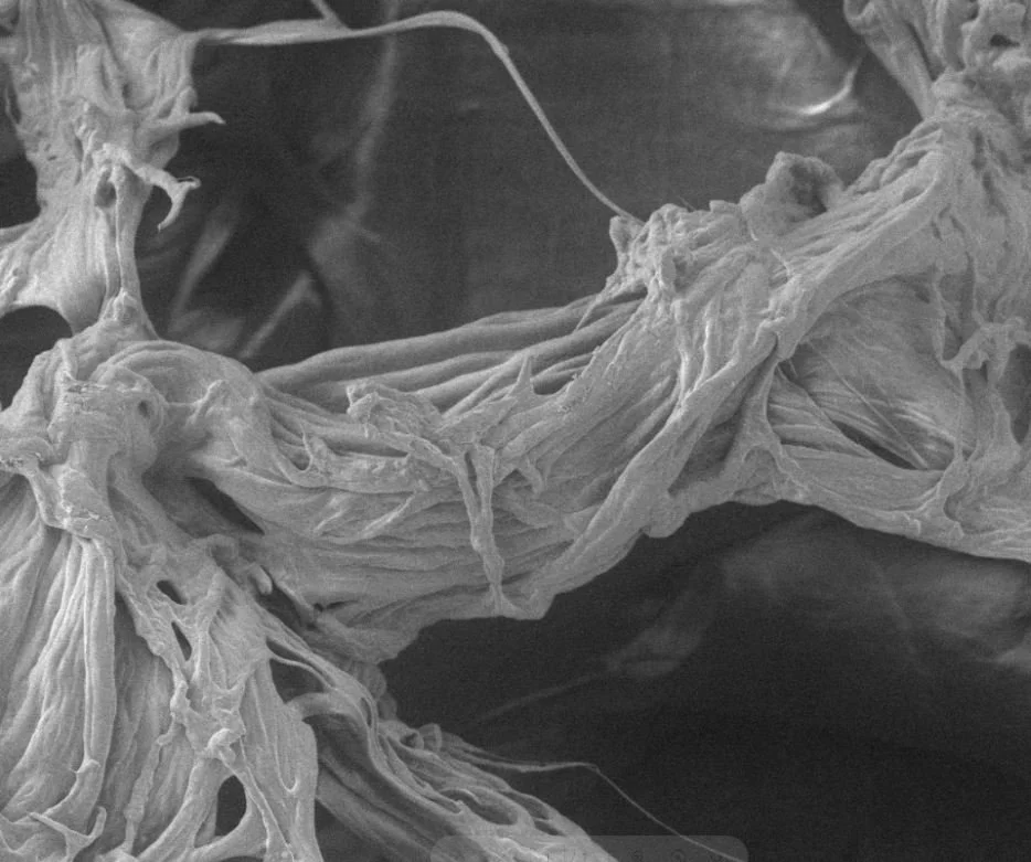SEM image of polymeric hydrogels