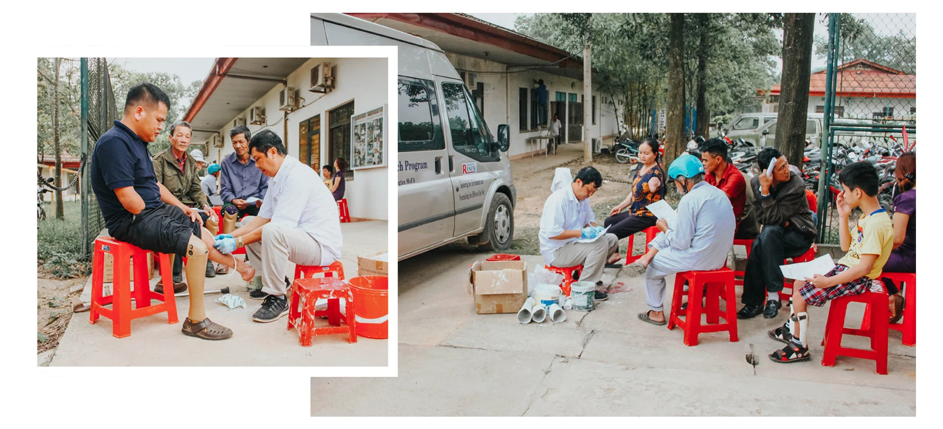 Mỗi người đều có khuyết tật về chi khác nhau, cần phải đo đạc để đúng kích cỡ
