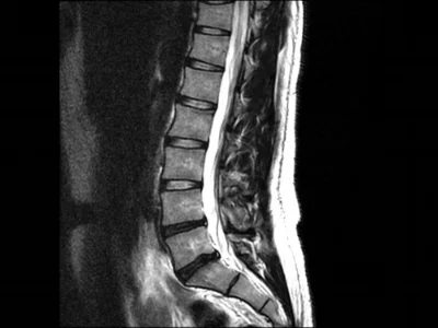 MRI of a low back (side profile) (What am I even looking at!?) 