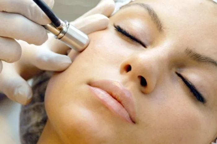 microdermabrasion_pittsburgh_3.jpg