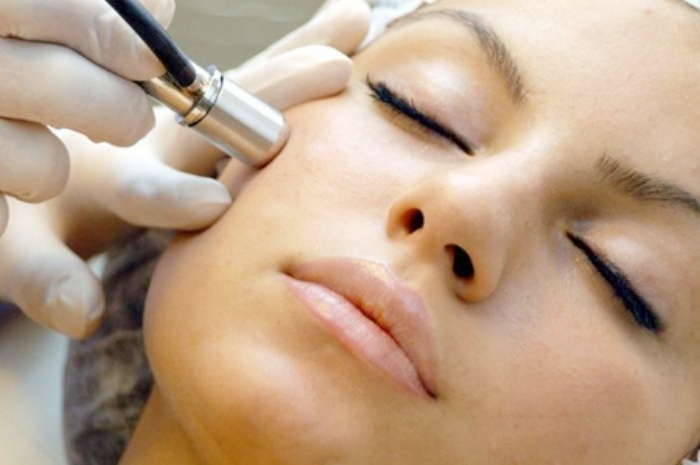 microdermabrasion toronto