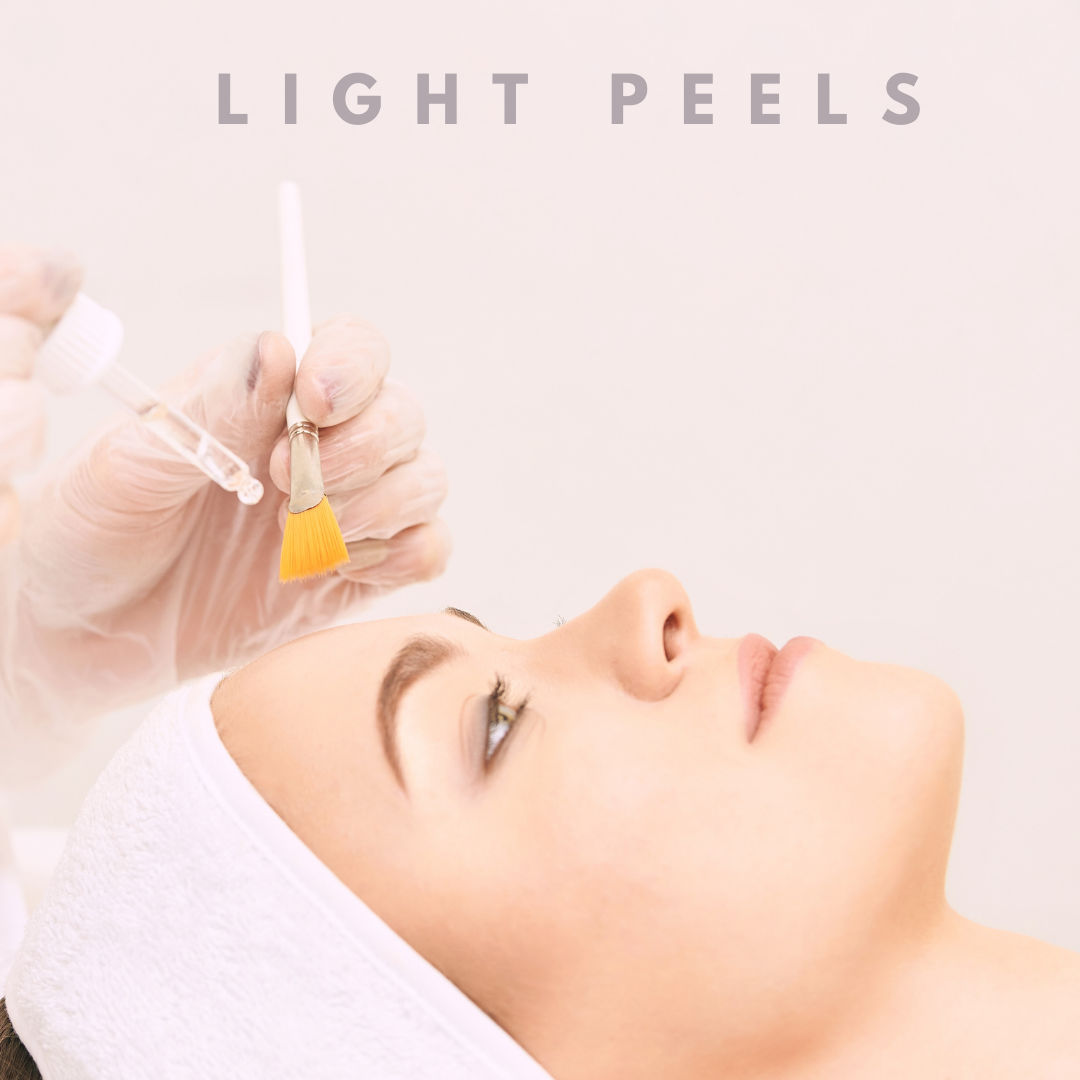 Light Chemical Peels