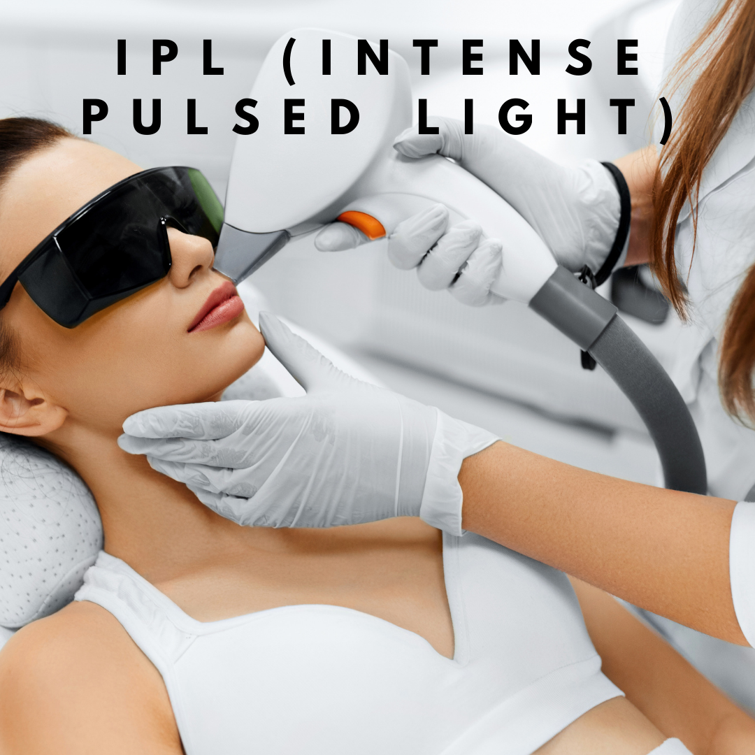 IPL Intense Pulsed Light Bozeman