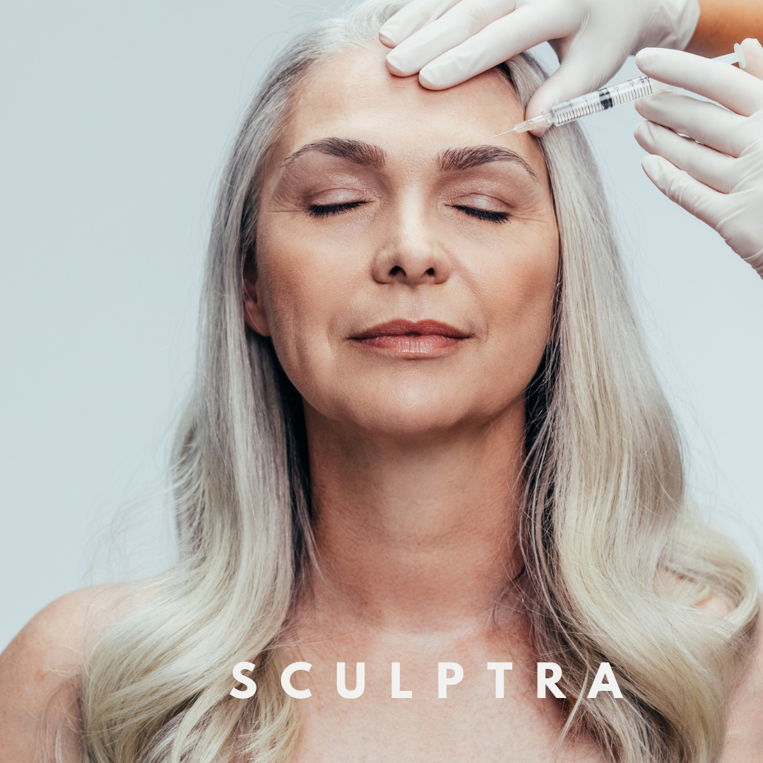 Sculptra in Bozeman MT 