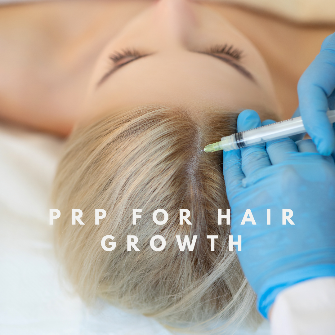 PRP for hair loss 