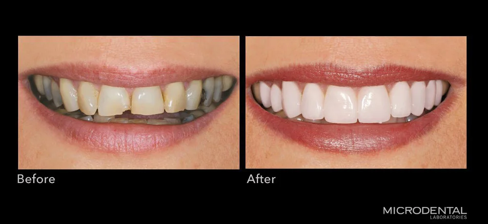 Gallery — MicroDental Las Vegas