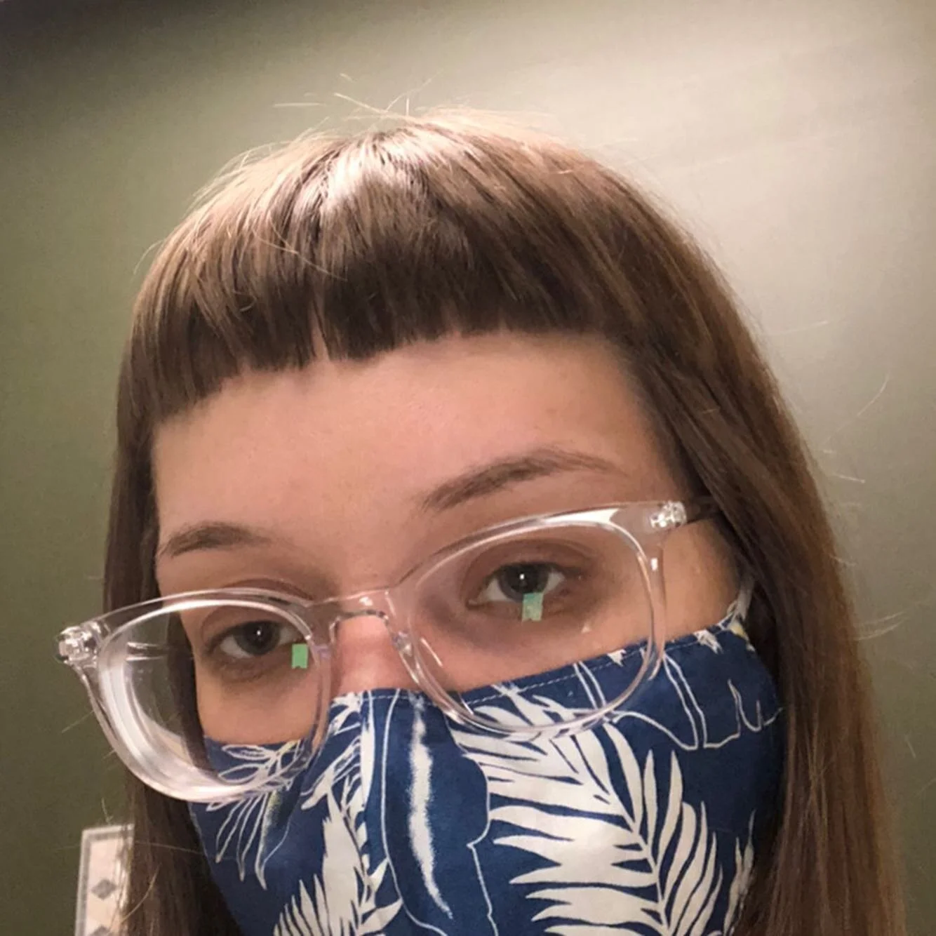 three retinopexy surgeries in seven weeks 🩸 I&rsquo;m no longer at high risk of retinal detachment and am so ready to end my art hiatus !!

ty if you care or stuck around 🥀