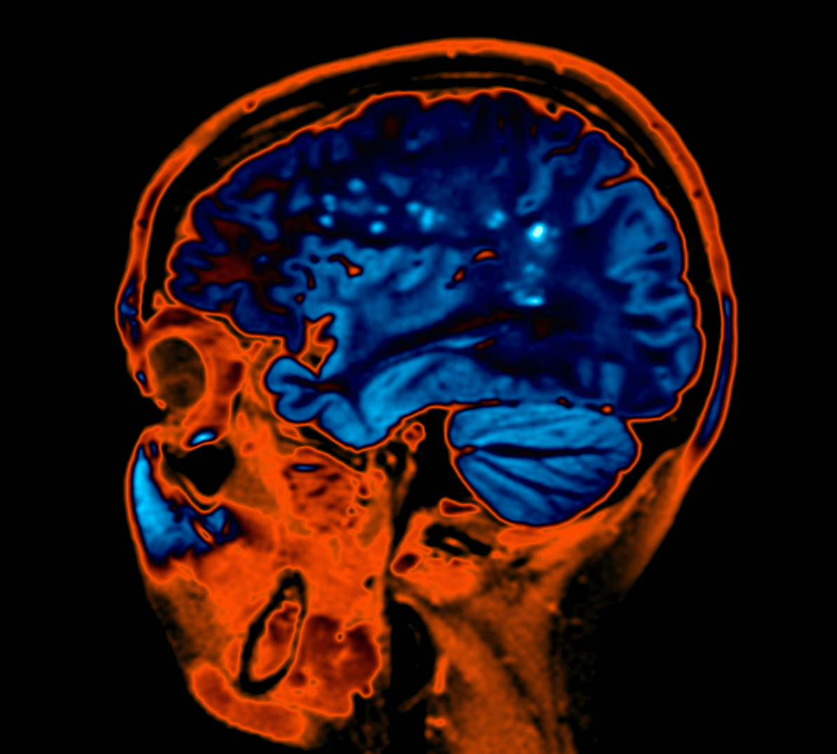 Training the neurologists of tomorrow