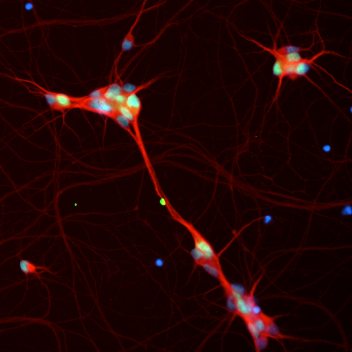 MN MAP 2 neuron.png